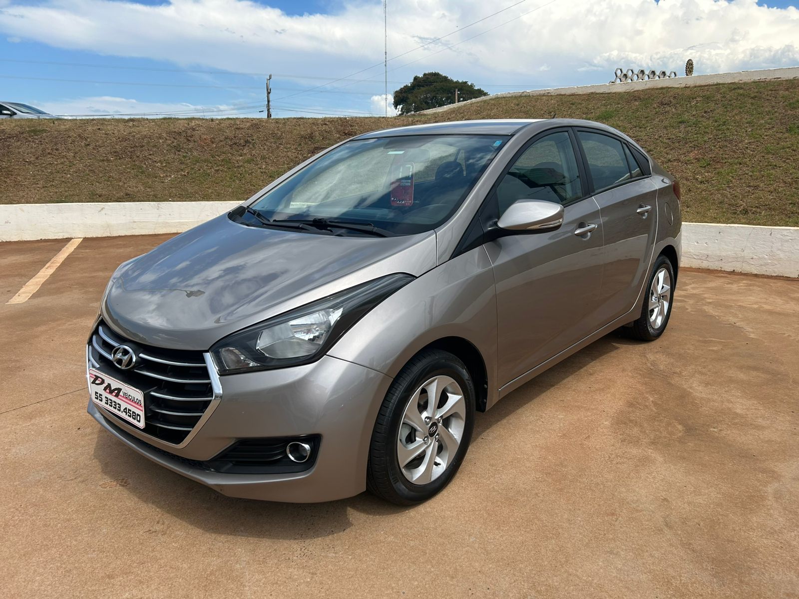 Hyundai Hb20s 2017